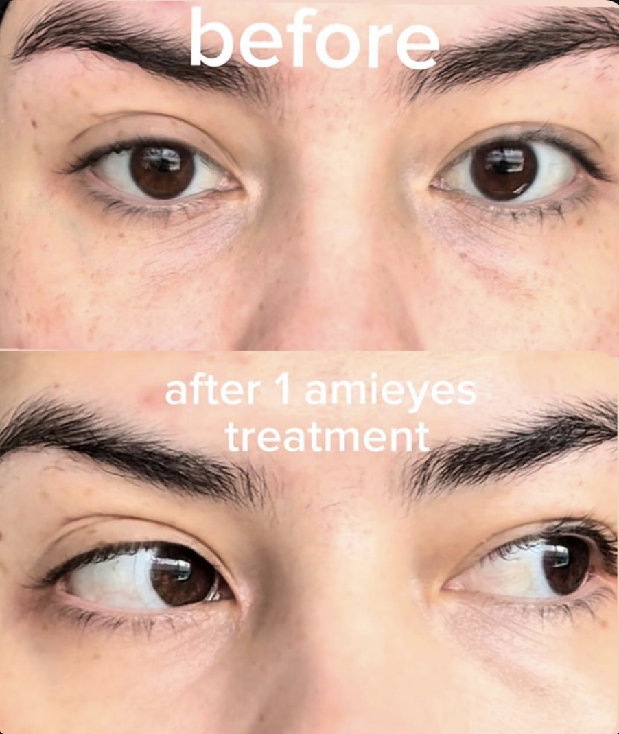 AMI eyes (PN) photo review